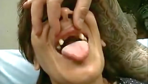 Toothless mature demolition